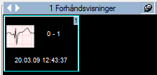 15 15. EKG HÅNDTERING 15.1. VISNING AV DICOM EKG For å kunne vise DICOM EKG i ComPACS, så må EKG Viewer modulen være lisensiert.