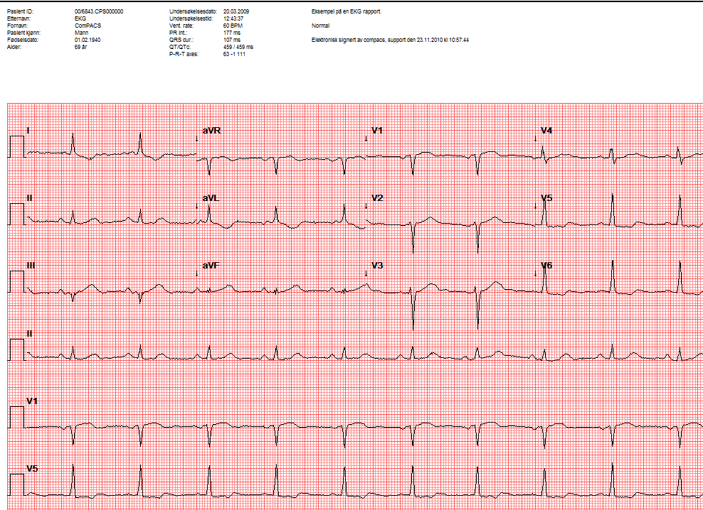 EKG objekter kan også bli prosessert med de samme verktøy som beskrevet i denne manualen for bilde-objekter.