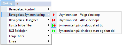 visning. Disse settingene er kun midlertidige og vil bli tapt neste gang cineloopen blir åpnet for 6.3.