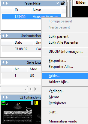 For å arkivere bildene som er vist eller åpnet for visning, så kan du ganske enkelt høyre-klikke på forhåndsvisningen, series, undersøkelse eller pasient i service vinduet og så velge arkiv