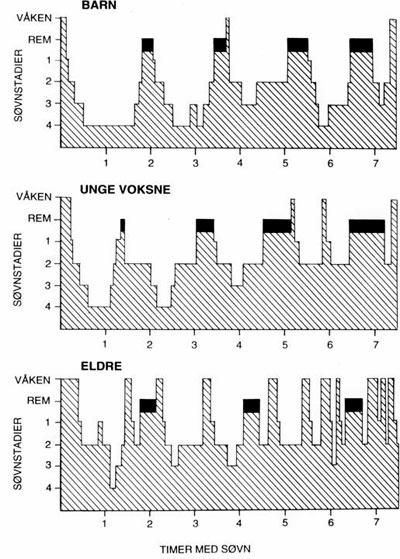 REM- søvn stadier 1-4 nødvendig!