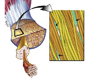 promote tissue healing The effect of exercise Eccentric exercise, Khan &Scott 2009 Wall ME et al