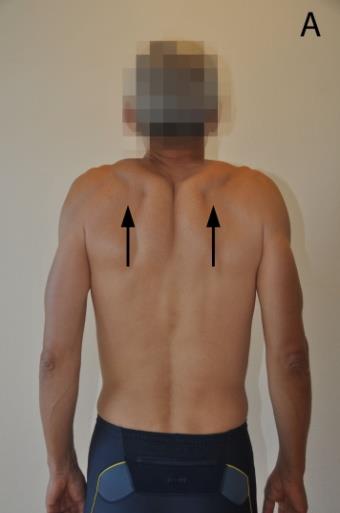 Øvelse 1 Utgangsstilling: Stå foran speil, armene avslappet langs kroppen Øvelse: Trekk skuldrene oppover (A), trekk skulderbladene sammen (B),