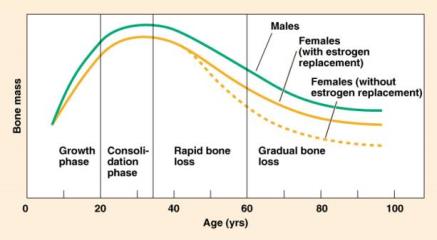 Vanlige brudd Lavenergibrudd er en multifaktoriell hendelse Ryggrad Underarm, håndledd Hofte (lårhals, trokanter) Bilde: National Osteoporosis Foundation, USA. http://nof.