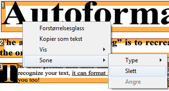 Del 8: Redigere gjenkjenningssonene De to sonene er nå gjort om til én. Det er bare soner av samme type som kan kobles sammen.