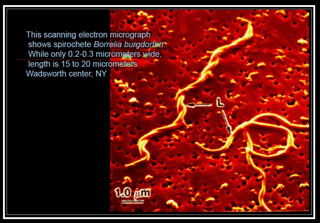 Spirochaetaceae Genus Borrelia