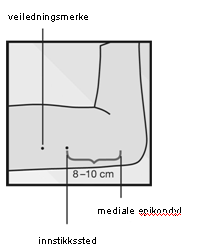 La kvinnen ligge på ryggen på undersøkelsesbordet med den ikke-dominante armen bøyd ved albuen og vendt utover slik at håndleddet er parallelt med øret eller hånden plassert nær hodet (figur 1).