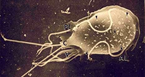 Første norske tilfelle av vannbåren giardia, Bergen 2004 Kom etter periode med mye regn, oversvømmelse av kloakken.