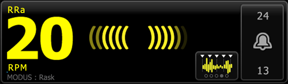 102 Pasientovervåking Welch Allyn Connex Vital Signs Monitor 6000 Series Akustisk respirasjonsfrekvens (RRa) Monitorer som er konfigurert med Masimo rainbow Acoustic Monitoring-teknologi, måler