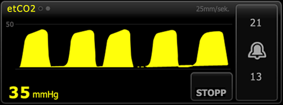 Bruksanvisning Pasientovervåking 93 Tallvisning av etco2 Tallvisningen inneholder endetidal CO2 (etco2) og fraksjon av innåndet CO2 (FiCO2) i mmhg eller kpa.