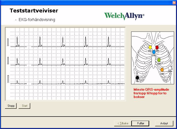 Bruksanvisning 11 Kun SD-kort Ingen EKG-forhåndsvisning 1. Klargjøre pasienten i henhold til bruksanvisningen for HR100/300/1200. 2. Ta ut batteridekslet. 3. Ta ut SD-kortet fra apparatet. 4.