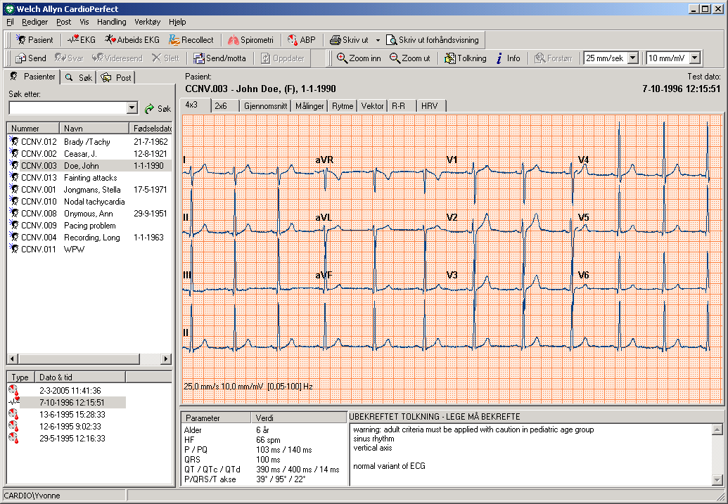 1. Komme i gang 1.1 Welch Allyn Cardio Perfect hvile-ekg-vindu I denne delen finner du informasjon om de ulike delene av Welch Allyn CardioPerfect hvile- EKG-modulen.