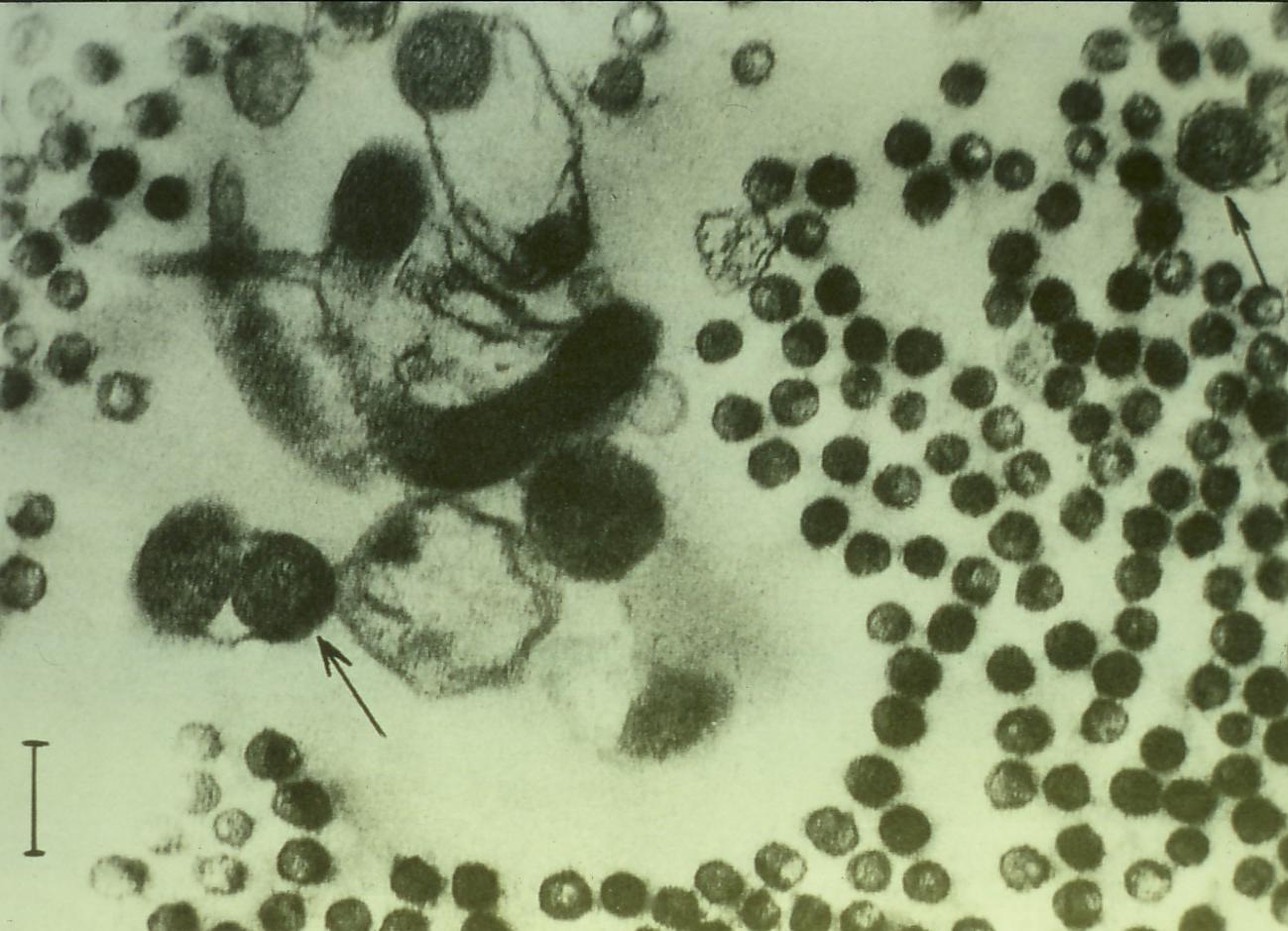 Borrelia burgdorferi cyster in vivo Cyste strukturer