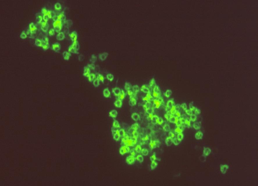 Antigen forandring Positiv reaksjon med Osp A protein i Borrelia burgdorferi cyster. Proteinet er lokalisert inne i cysten.