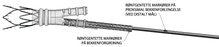 3 Se i tabellen under når det skal brukes en bekkenforgreining som forlengelse.