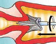 Endringer i programmet HPV-testing