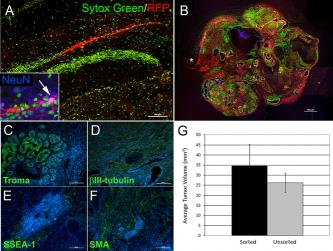 Rapamycin et anti-sopp middel funnet på Rapa Nui (Påskeøya) Rapamycin påvirker mtor Rapamycin allerede i bruk i epilepsibehandling ved TS Er rapamycin også et antiepileptogent medikament?