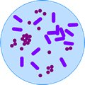 Del 2: Bruk av de enkelte kodeverk Kapittel 3 Introduksjon til ICD-10 XVIII - Symptomer, tegn, unormale kliniske funn og laboratoriefunn, ikke klassifisert annet sted (R00-R99) XIX - Skader,