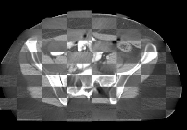 24 3. MATERIALER OG METODE Figur 3.3.1: Bildet viser hvordan funksjonen checkerboard kan brukes til å evaluere samregistrering mellom to bildeserier POI i et felles koordinatsystem.