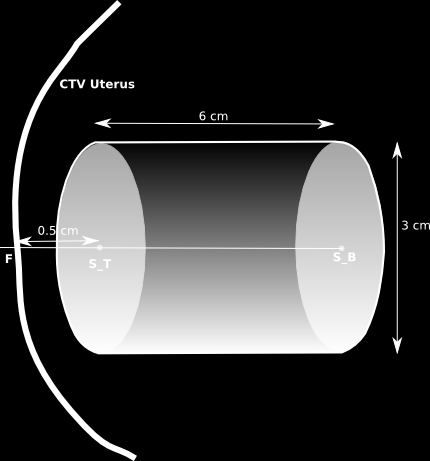 3. MATERIALER OG METODE 25 3.4 Uterusmodell Siden uterus kun er definert i planleggingsct, ble det i denne oppgaven laget en forenklet modell av uterus.