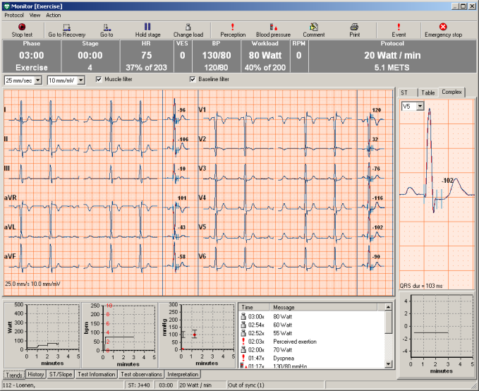 2. Opptak av arbeids-ekg 2.1 Sanntidsskjermen Sanntidsskjermen vises når du starter et nytt arbeids-ekg.