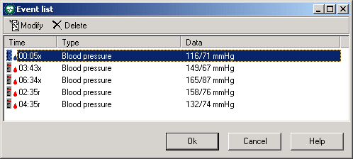 PVC run Kuplett Hjertestans Når Welch Allyn CardioPerfect arbeids-ekg registrerer en arytmi, opprettes det en hendelse som viser hendelsestidspunktet og en beskrivelse av arytmien.