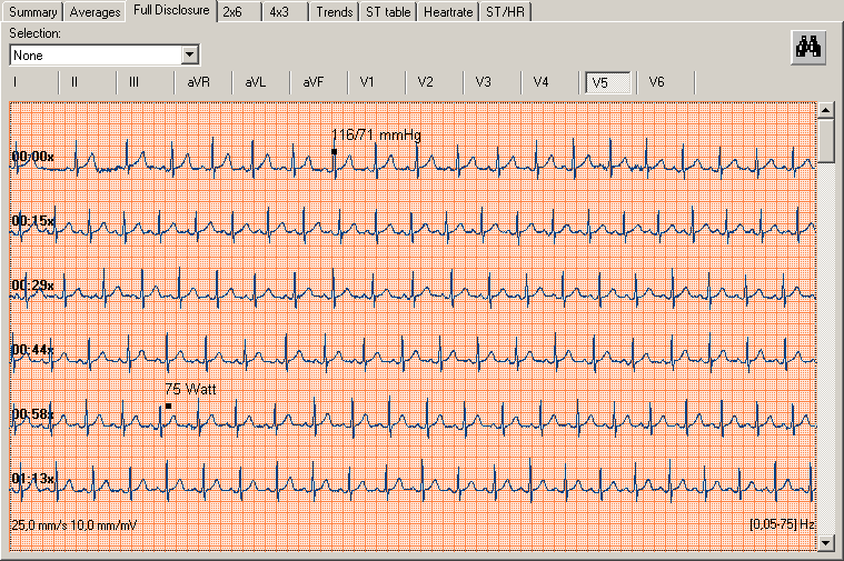 Slik veksler du mellom data for komplett avledning og gjennomsnitt: 1. I komplettavledningsvisning klikker du med høyre museknapp på punktet du vil vise i gjennomsnittsvisning. 2.