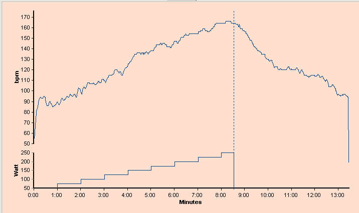 3.9 Jobbe med hjertefrekvensvisning 3.9.1. Hjertefrekvensvisning Hjertefrekvensvisningen viser informasjon om hvordan pasientens hjertefrekvens forløp under testen.