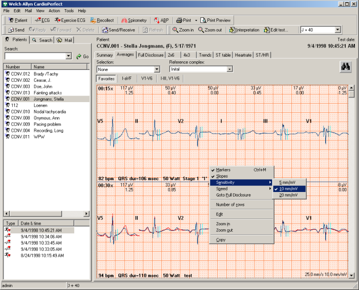 1. Komme i gang 1.1 Welch Allyn CardioPerfect arbeids-ekg-vinduet I denne delen finner du informasjon om de ulike delene av Welch Allyn CardioPerfect arbeids- EKG-modulen.