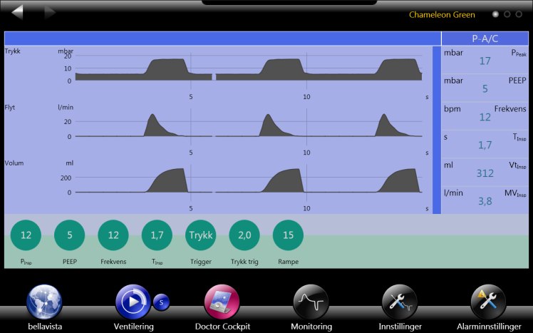 Under ventileringen 1 5 4 3 2 Chameleon Green-skjerm Chameleon Med Chameleon-applikasjonen kan du betjene bellavista på liknende måte som andre respiratorer. Dermed kan opplæringstiden reduseres.