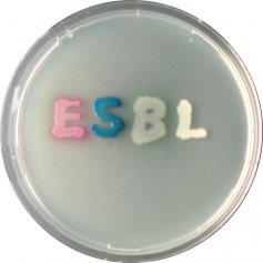 SCREENING: KROMAGAR ChromID ESBL (BioMerieux) Brilliance ESBL (Oxoid) CHROMagar ESBL (Chromagar/SmithMed) ESBL A + ESBL