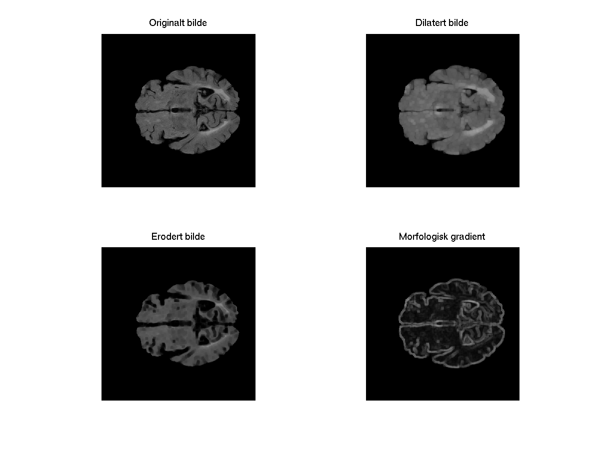 og en intern gradient definert som: grad int,bi (f) = f (f b i ) Figur 2.9.