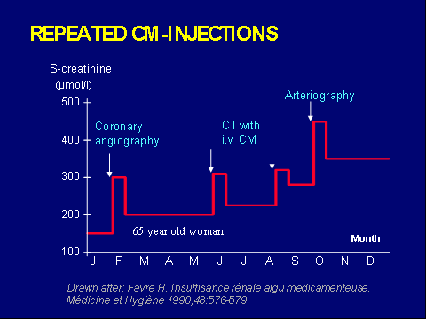 Figur 6 Stigning av baseline serum-kreatinin. (Favre, 1990) I figur 6 ses at en 65 år gammel kvinne i løpet av et år har fått økt sin baseline serum-kreatinin verdi fra ca 150 til 350 μmol/l.