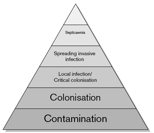 Overgangen fra kolonisering til infeksjon er avhengig av flere faktorer: Antall bakterier Bakterie-arter tilstede i såret Antall ulike bakterie-arter
