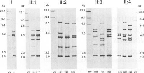 Ribotyping Available