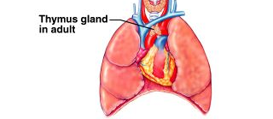 Alvorlig kombinert immunsvikt (Severe Combined Immune Deficiency SCID) Ingen symptomer ved fødsel, gjentatte infeksjoner i første