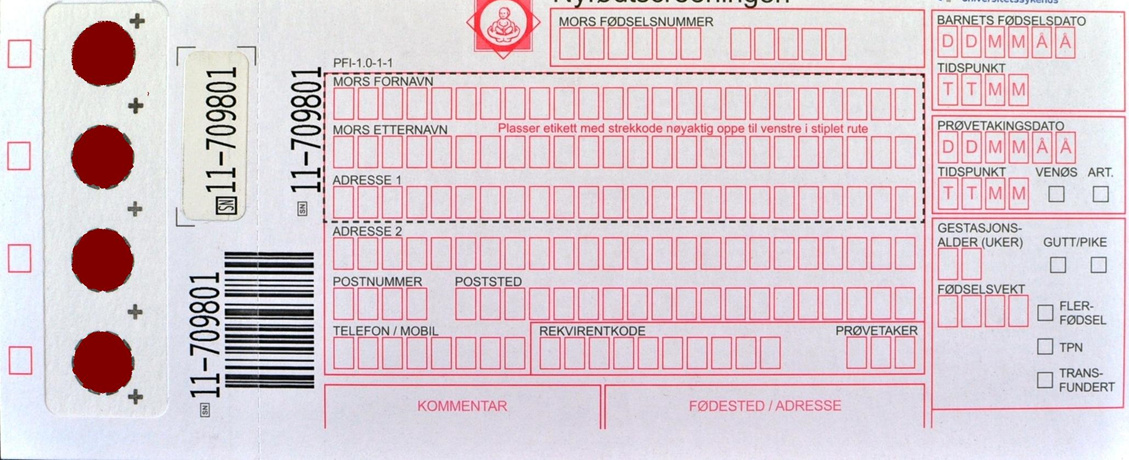 Nyfødtscreeningen Screening for 23 medfødte sykdommer Tilbudet gjelder for alle barn i Norge ved alder 24-72 timer Noen dråper blod på et