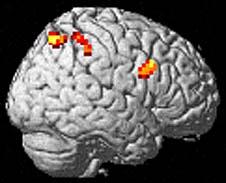fmri-group in Bergen 2008 The effect of alcohol on working memory