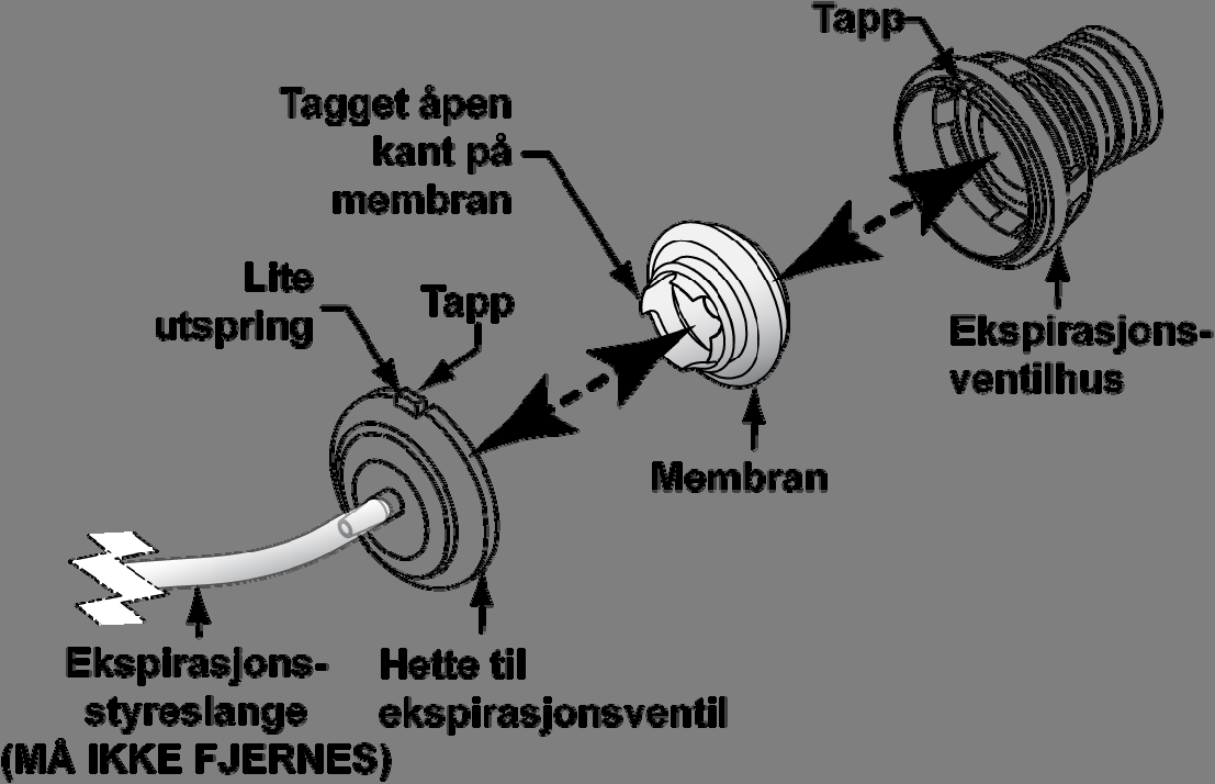 Når pasientkretsen (slanger og alt tilbehør) skal rengjøres eller desinfiseres, må den kobles fra ventilatoren: 1) Koble pasientkretsen fra ventilatoren.