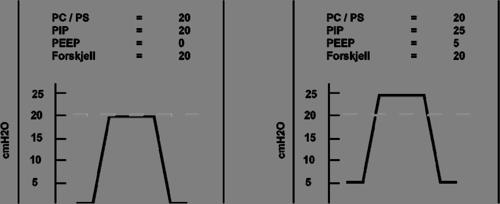 PEEP-kontroll PEEP betyr positivt endeekspiratorisk trykk. Slik stiller du inn PEEP: 1) Trykk på PEEP. 2) Endre innstillingen ved å bruke Innstilling-hjulet.