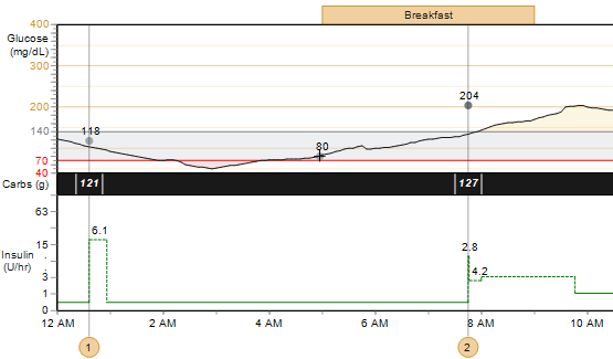 Glukose, karbohydrater og insulin Denne grafen gir en oversikt over pasientens glukoseverdier, karbohydratinntak og insulinbruk i løpet av en valgt dag.