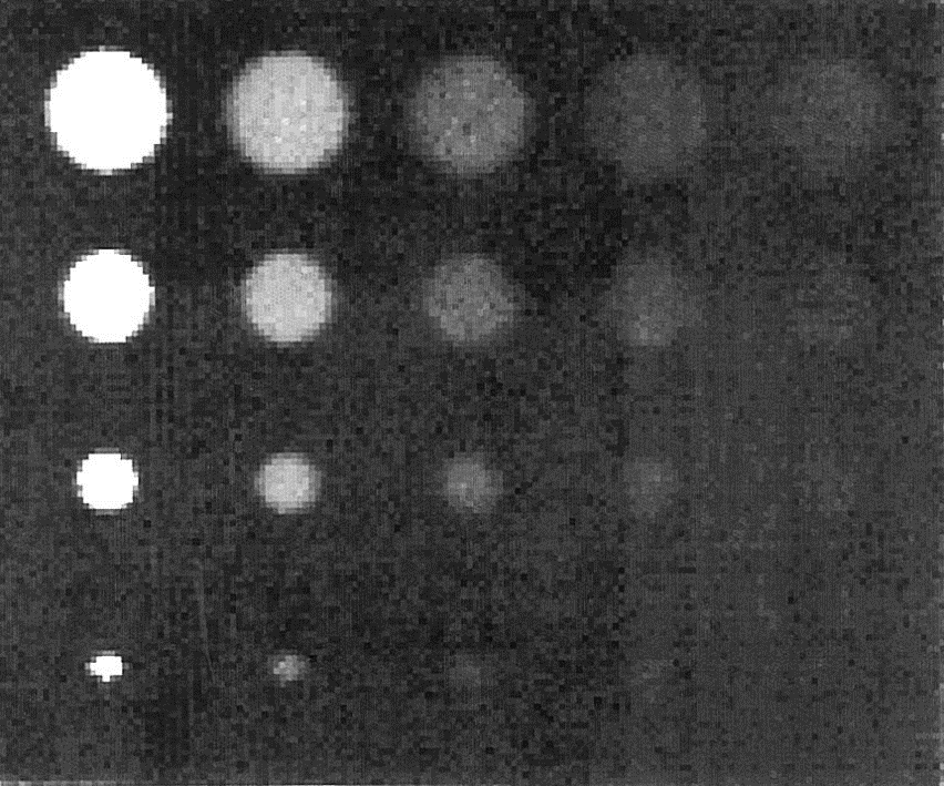 , A detector system for proton radiography on the gantry of the Paul-Scherrer- Institute.