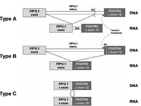 Figur 5. Oversikt over 3 FIP1L1-PDGFRA mrna-transkript beskrevet.