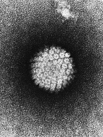 Virus HPV (= humant papillomavirus) er den vanligste seksuelt overførbare infeksjonen i verden, og ca 70% blir smittet av HPV i løpet av livet Kjønnsvorter og kreft hos kvinner og menn Øker risiko