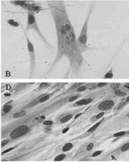 Optimal dose for laser Fibroblastcells increased collagen fibre production most: Dose 0.14-1.4 J/cm 2 Intensity 4.5 mw/cm 2 (Loevschall & Arenholdt-Bindslev -94) Frigo, Lopes-Martins, Bjordal et al.