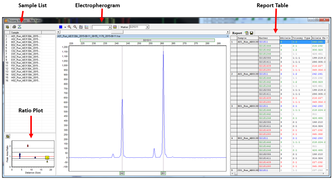 Vinduet Trisomy Analysis (trisomianalyse) Vinduet Trisomy Analysis (trisomianalyse) (Figur 23) gjør det mulig for operatøren å gjennomgå QST*R-prøvedata og vise forholdet mellom topper for hver