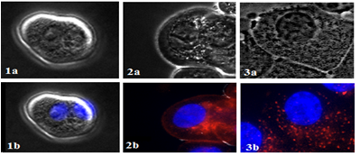 3.3 Cellulær viabilitet etter PDT- og PCI-behandling 47 Figur 3.3: Lokalisering av TPCS 2a i ZR-75-1 celler.