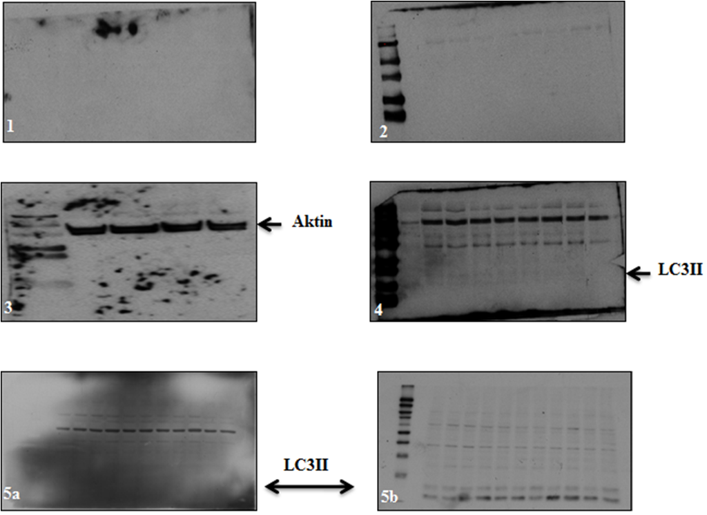 3.6 Immunodeteksjon med SNAP i.d 57 Figur 3.13: Proteindetektering med SNAP i.d. Bildet viser diverse resultater fra immunodeteksjon med SNAP i.d. gjort på ZR-75-1 og NuTu-19 celler behandlet med PDT.