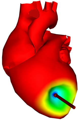 Figur 6.1: Illustrasjon av visualisering av spenning i materialet. det være naturlig å studere løsningsmetoder som ikke benytter seg av invertering av stivhetsmatrisen.