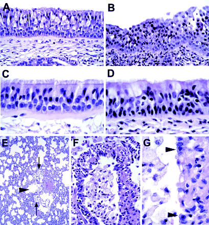 Parainfluenza Species types 1 and 3 types 2 and 4 Mumps Measles Respiratory syncytial virus (RSV) Human metapneumovirus (hmpv) Days post-inoculation 13 N Engl J Med 2004 14 Kuiken T Am J Pathol 2004